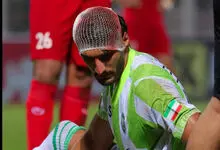 سر شکسته و صورت خونی، عکس ترسناک از لیگ ایران!