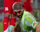 سر شکسته و صورت خونی، عکس ترسناک از لیگ ایران!