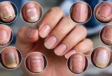 ناخن‌هایتان چه چیزی درباره سلامت بدنتان می‌گویند؟