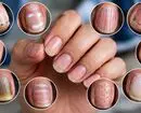 ناخن‌هایتان چه چیزی درباره سلامت بدنتان می‌گویند؟